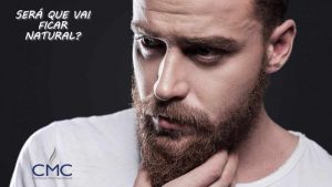 transplante de barba